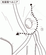 図03